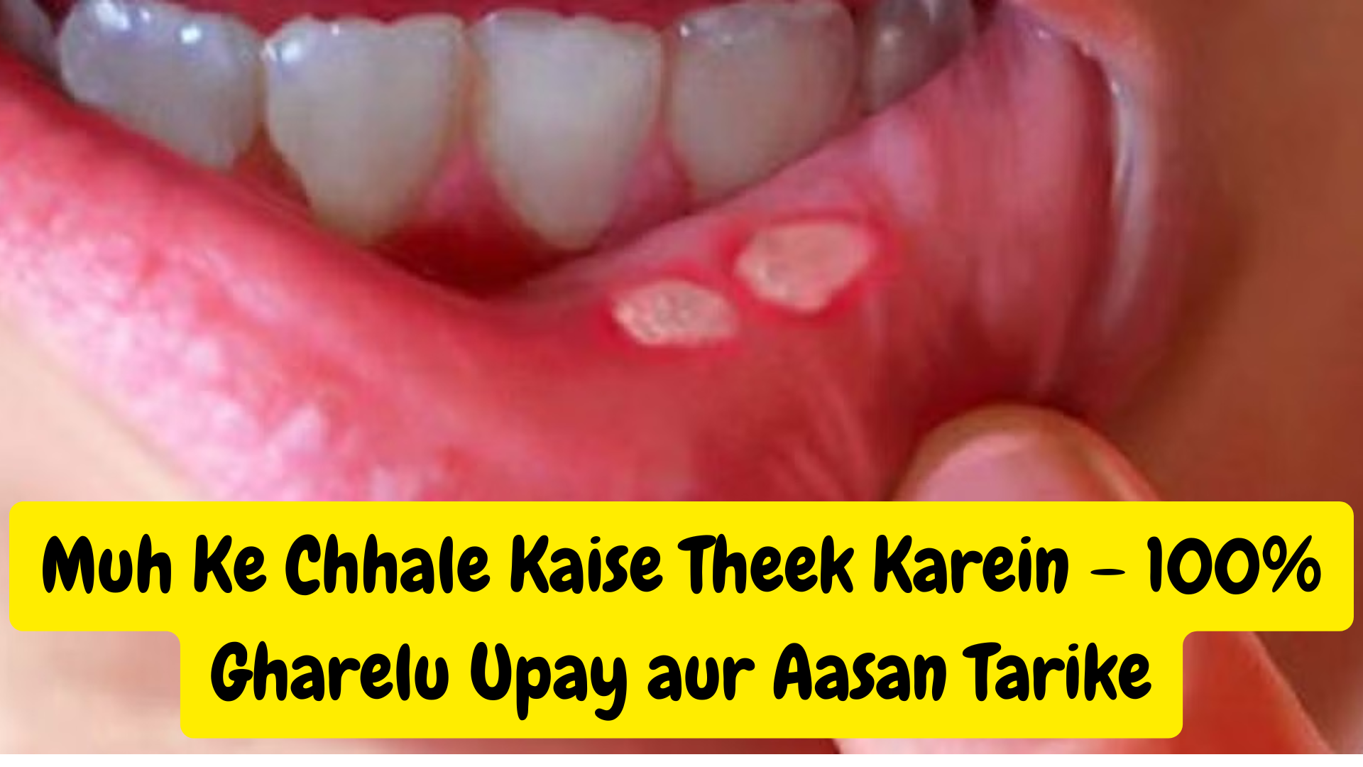 Muh Ke Chhale Kaise Theek Karein